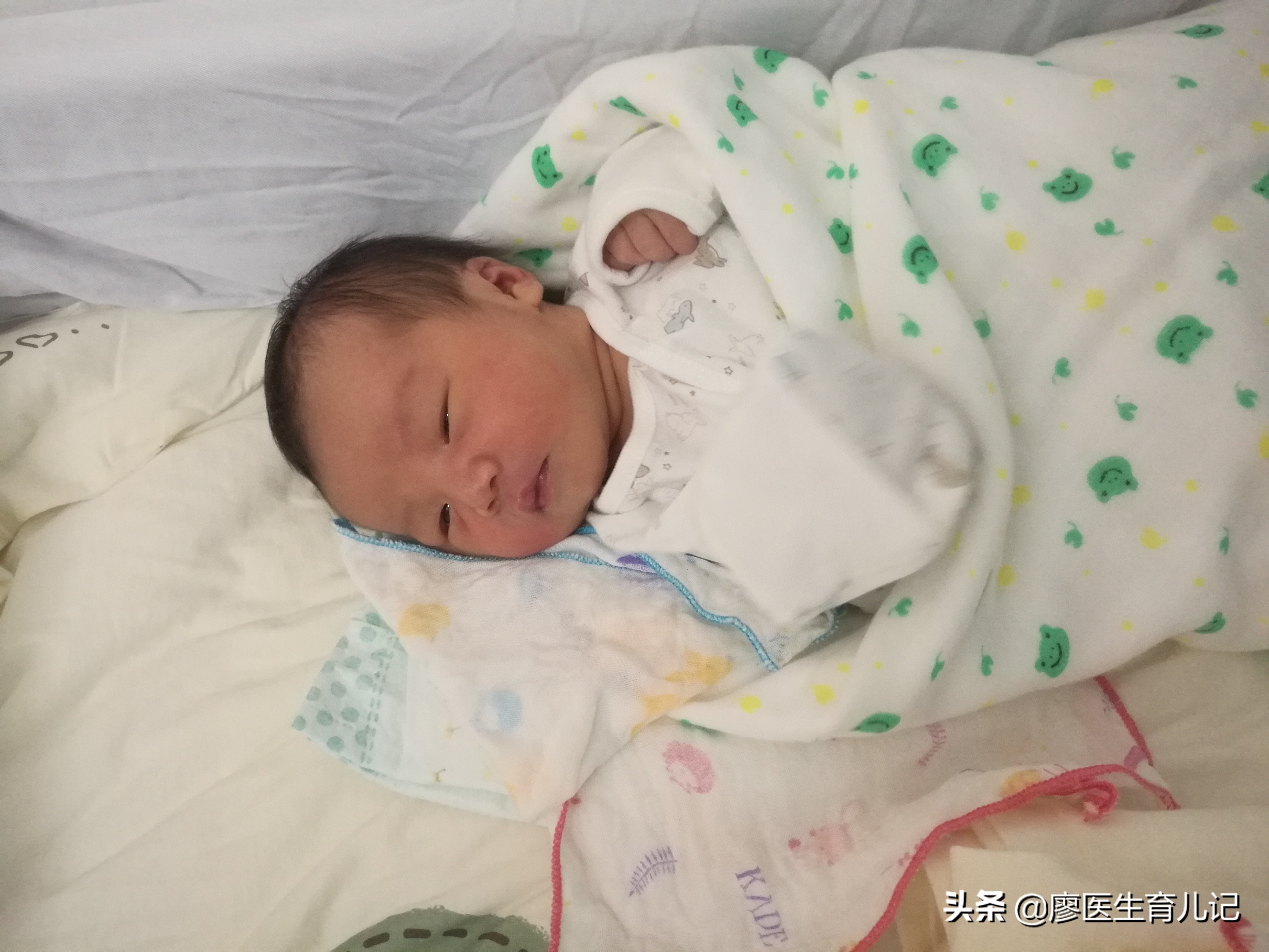 关于无痛分娩这14点你需要知道,无痛分娩其实很痛