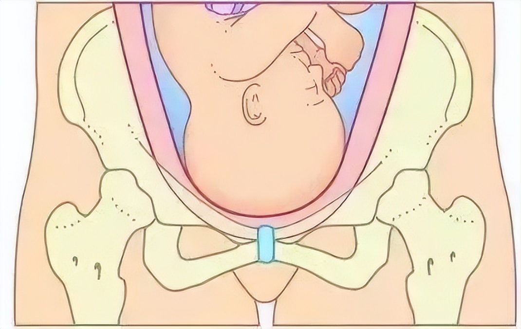 产后盆底受损应如何处理,产后盆底肌恢复的正确动作