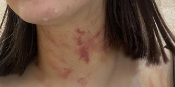 自述牵狗进电梯道歉,女生在电梯牵狗被夫妇殴打后续