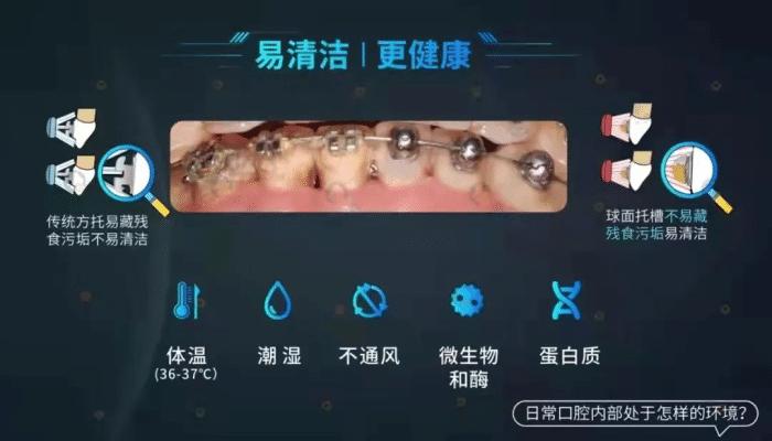 球托牙套,牙套很容易掉怎么办
