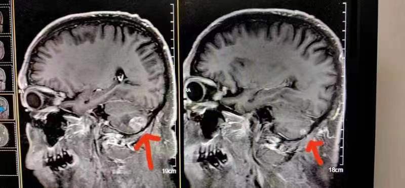 陈海林治疗癌症,陈海林肿瘤名医