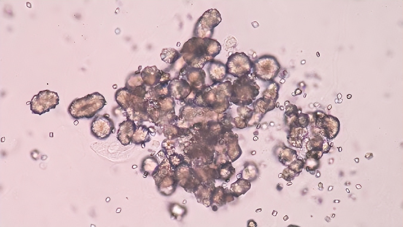 纤维素基水凝胶,纤维素水凝胶