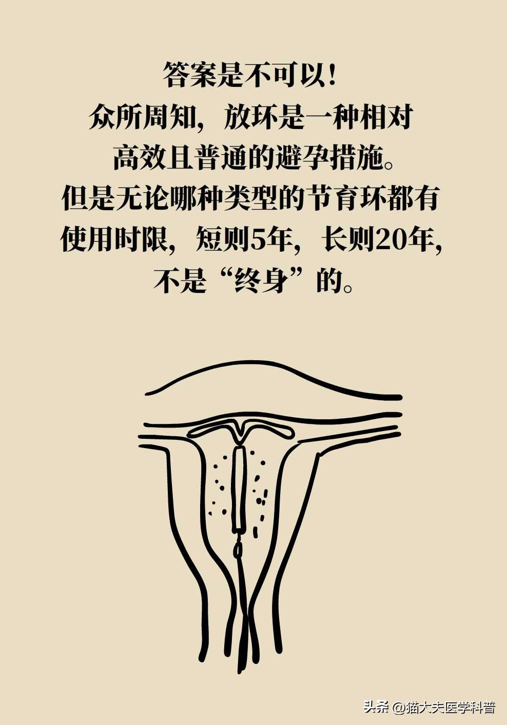 绝经后取环还会怀孕不,绝经后取环还能怀孕吗