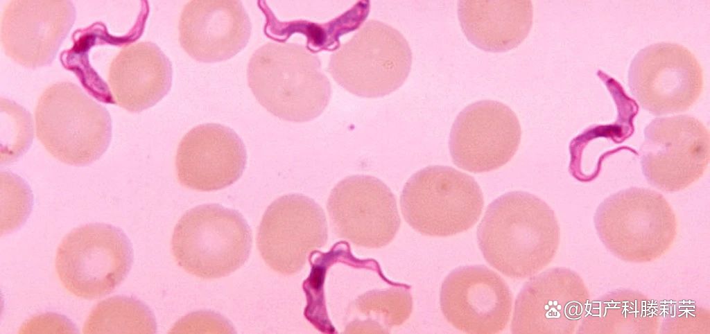 体检中发现HPV阳性，是得性病了吗？