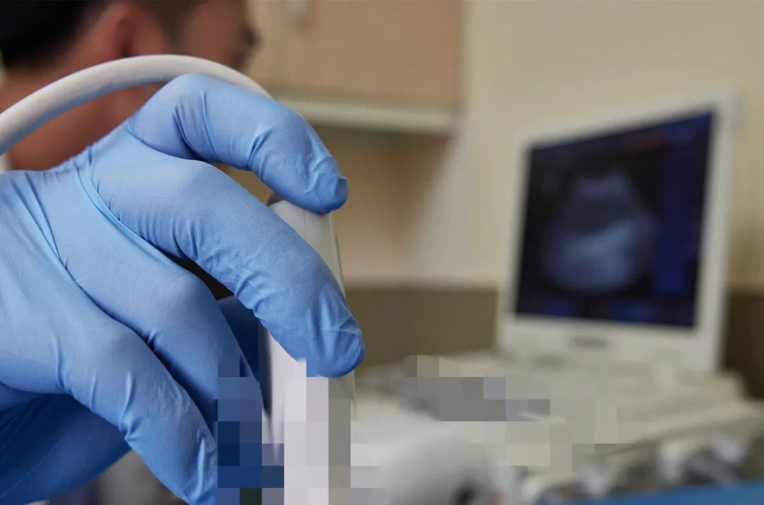 前列腺彩超憋尿吗,经直肠前列腺彩超