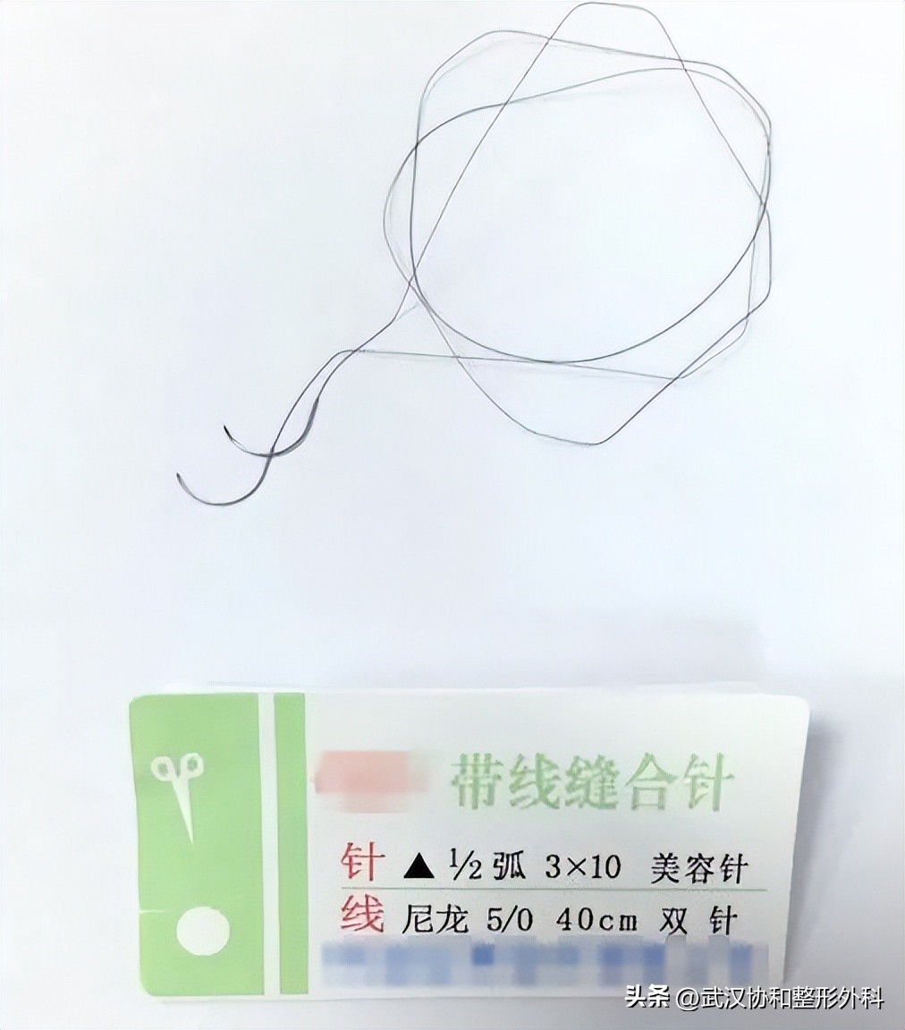 可吸收缝合线会留下疤痕吗,不想留疤不建议做什么缝合