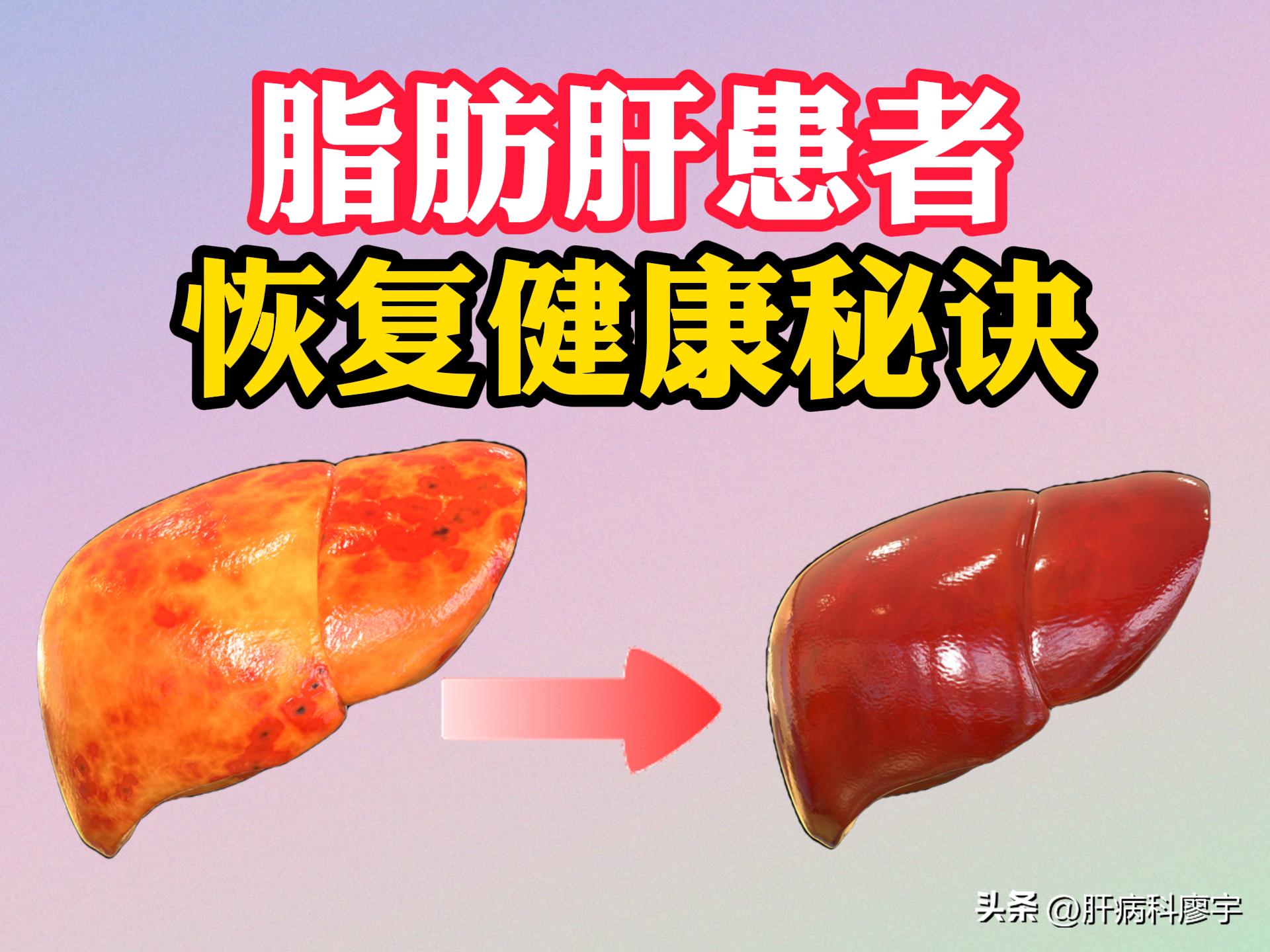 脂肪肝应该怎样养护肝脏,脂肪肝好了以后肝脏硬度恢复