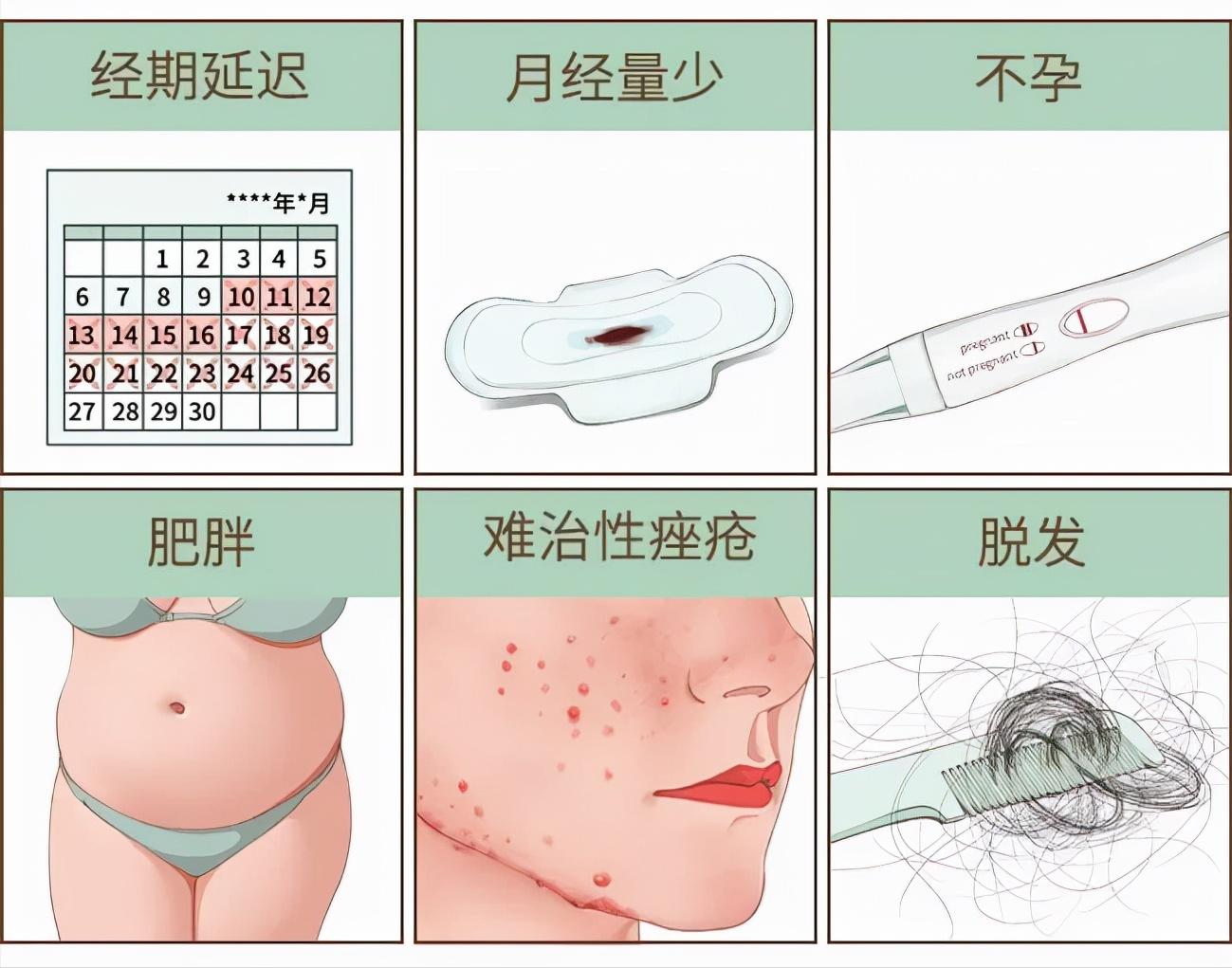 我月经不调,医生为什么给我开了避孕药?