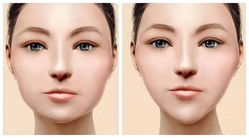 如何改善面部轮廓变好看,面部轮廓感不协调怎么微调