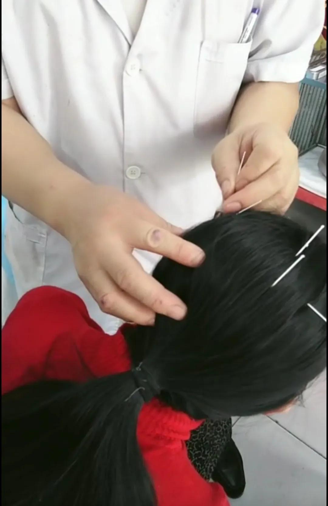 脑瘫关了我一扇门，却打开一扇天窗，让爱照耀进来，温暖我的一生