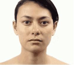 毛孔大到能插秧三招教你缩回去,毛孔粗到可以插秧该怎么自救