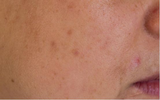 美白祛斑小窍门成就白皙水嫩肌肤,四种美白祛斑的方法斑点去无踪