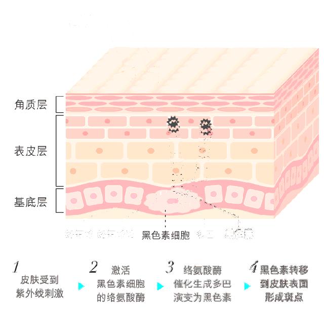 痘印和色斑什么东西最好遮,痘印色斑怎么最有效去除