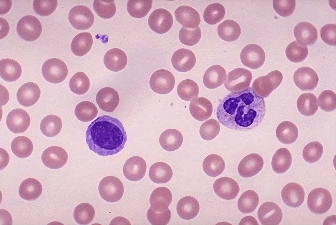 血常规最怕三种指标偏高一点点,血常规检查一些指标偏高一点点