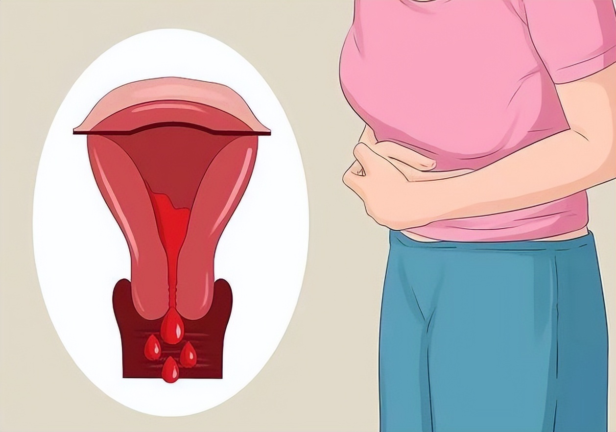 月经3天干净和7天干净哪个更好,月经期多少天干净是正常的