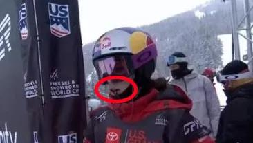 谷爱凌比赛时嘴里含的是什么“秘密*器武**”？