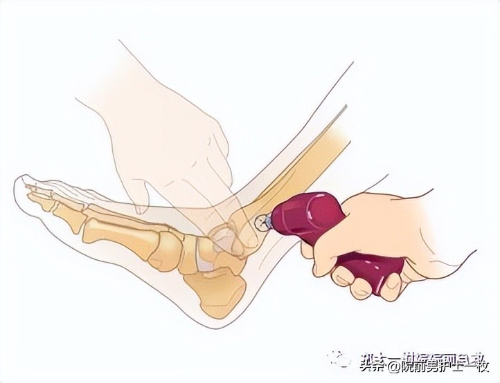 骨髓腔穿刺急救,骨髓腔穿刺适应症和禁忌症