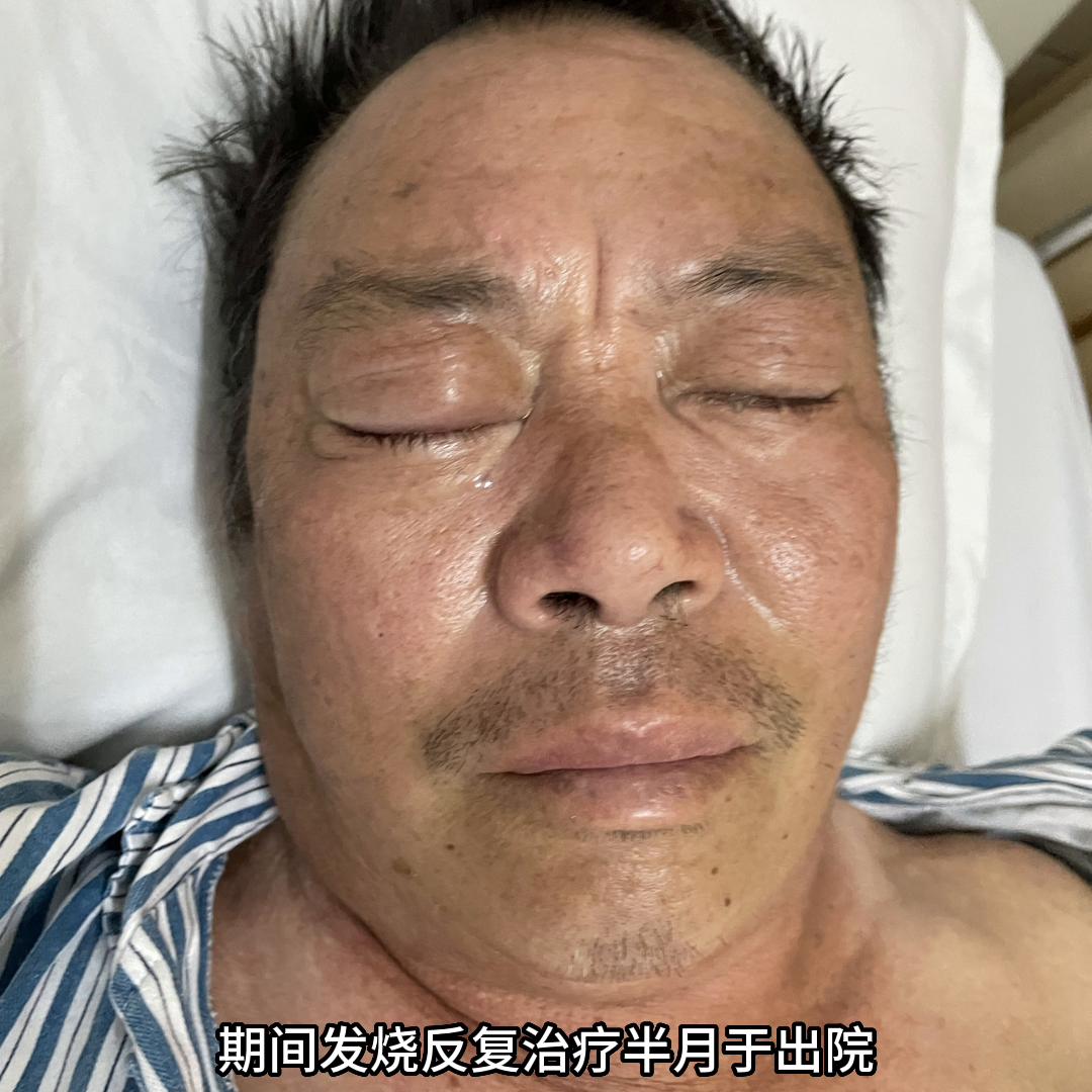 治了半年病好了怎么表达,怎么形容有病到康复的过程