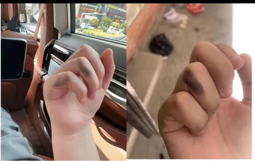 河南高考用笔问题进展,河南高考用笔事件怎么处理