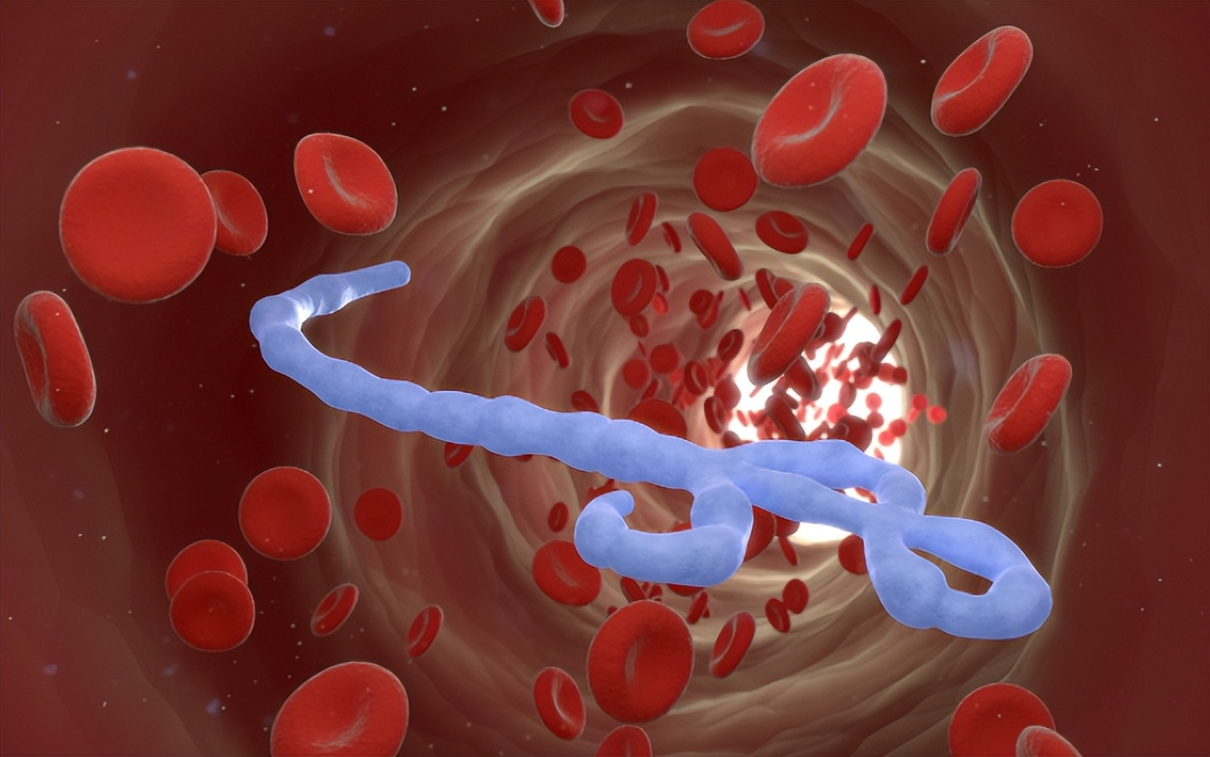 胆红素高用什么药可以很快降下来,直接胆红素和总胆红素高吃什么药