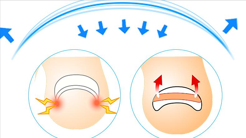 甲沟炎如何快速拔出脚趾甲,脚趾甲老往肉里钻一碰还疼