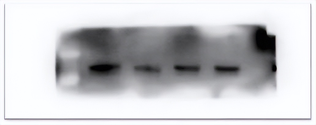 wb试验有条带为什么曝光,wb实验第二条带消失了
