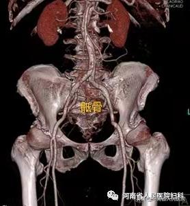 80后的难言之隐,难言之隐第十二集