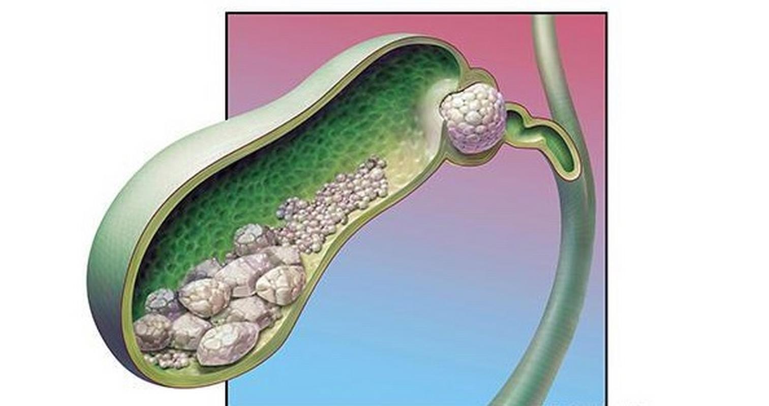 核桃适合什么体质的人吃,核桃是补肾的还是补脑