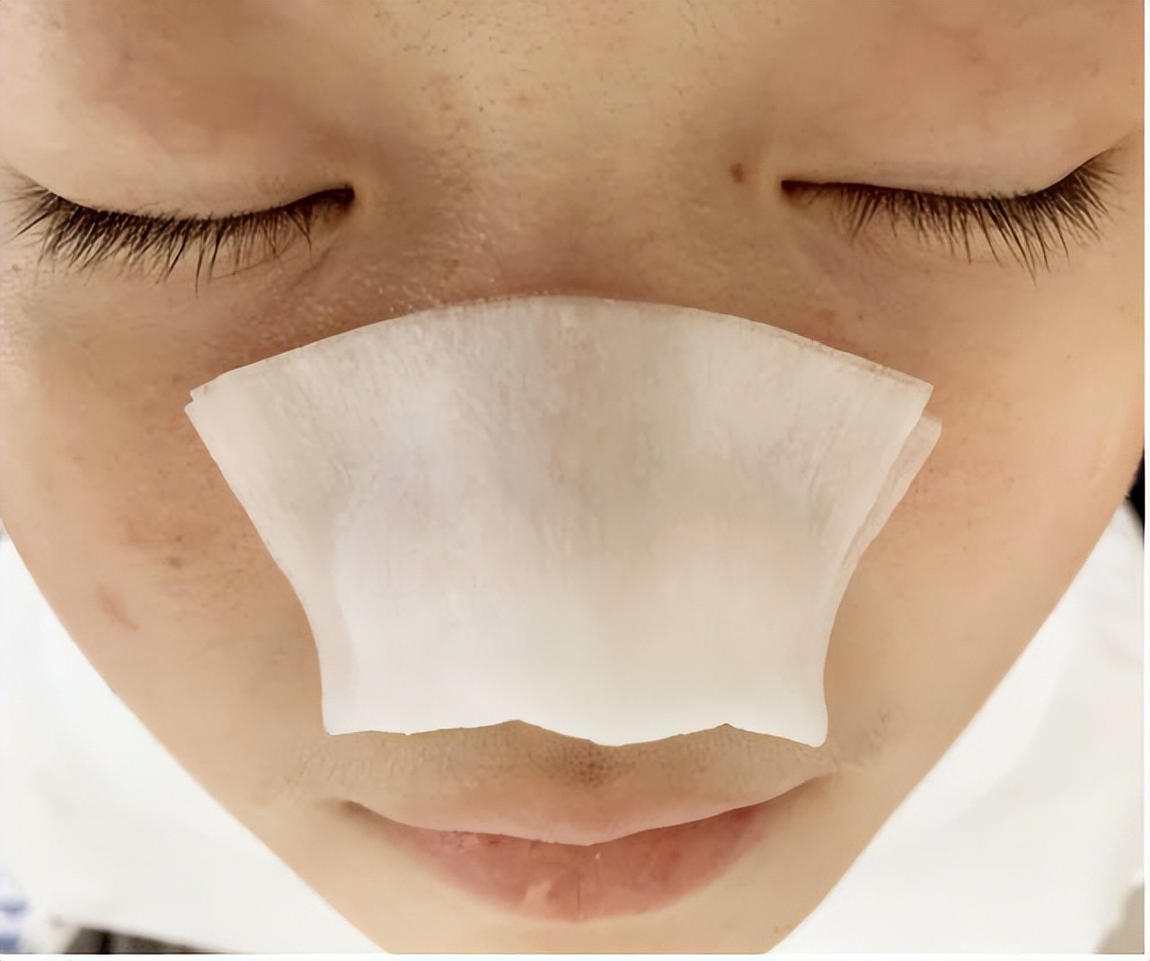 清洁面膜可以去黑头粉刺闭口吗,清洁面膜可以去除黑头吗