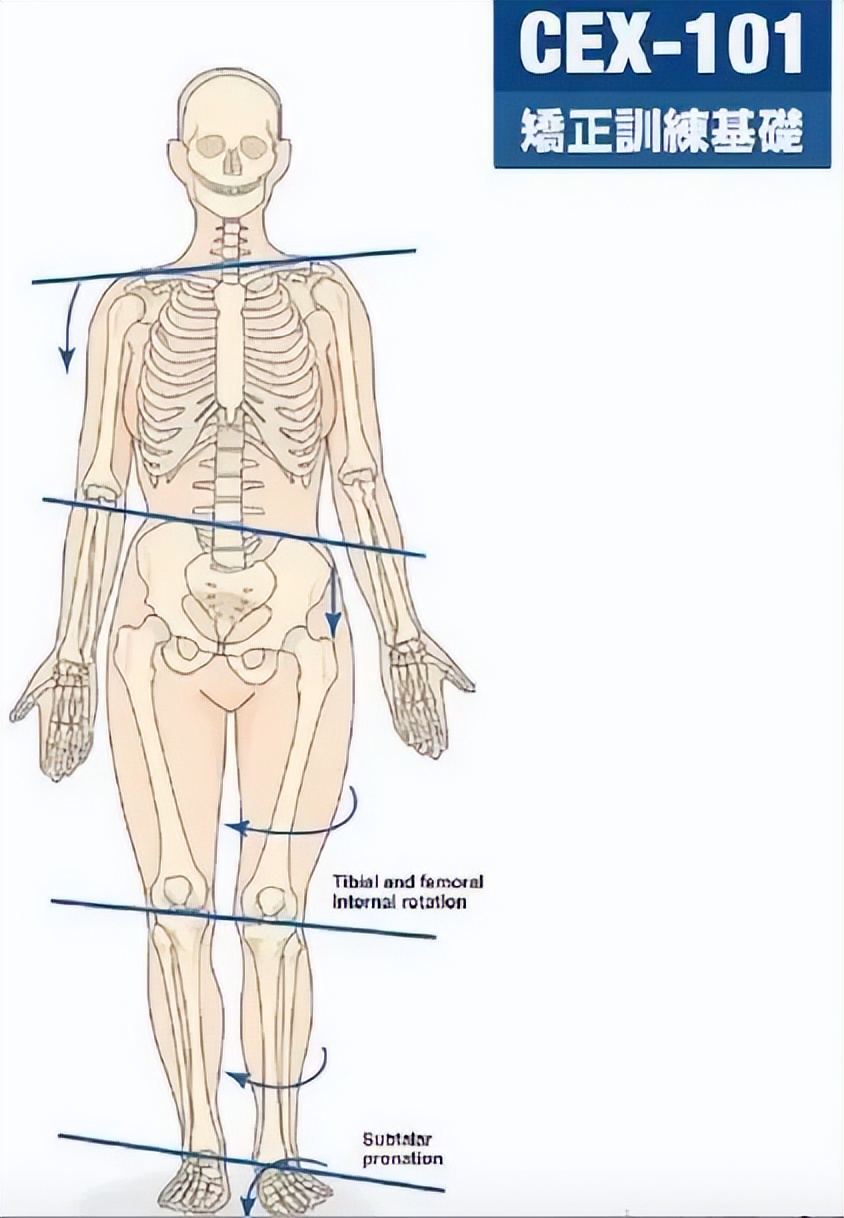 走路像鸭子臀中肌问题,走路左右摇摆像鸭子一样