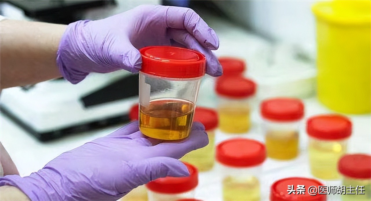 体检查出有肾结石要注意什么,体检检查出肾结石怎么处理