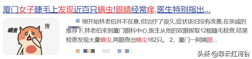 女子眼睛有虫子,眼睛干痒可能是眼睛里有虫