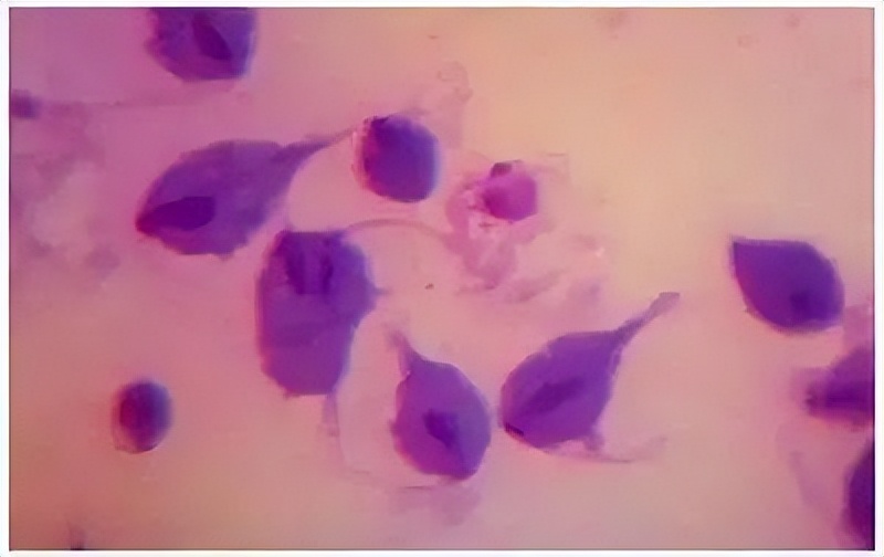 哪些疾病能通过性传播,六种疾病不能乱治