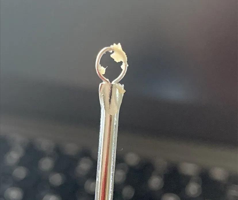 鼻子的黑头跟草莓一样,草莓黑头怎么去除最有效