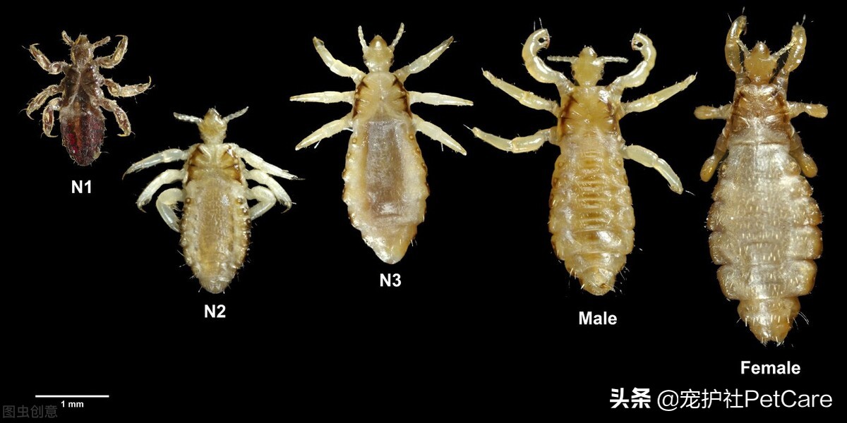 小孩长虱子卵最快处理法,头上长虱子最快解决方法