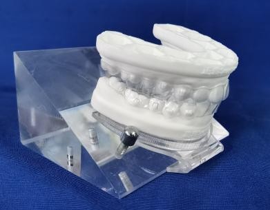 徐州儿童牙齿矫正牙齿不齐,大连口腔医院儿童牙齿矫正怎么样