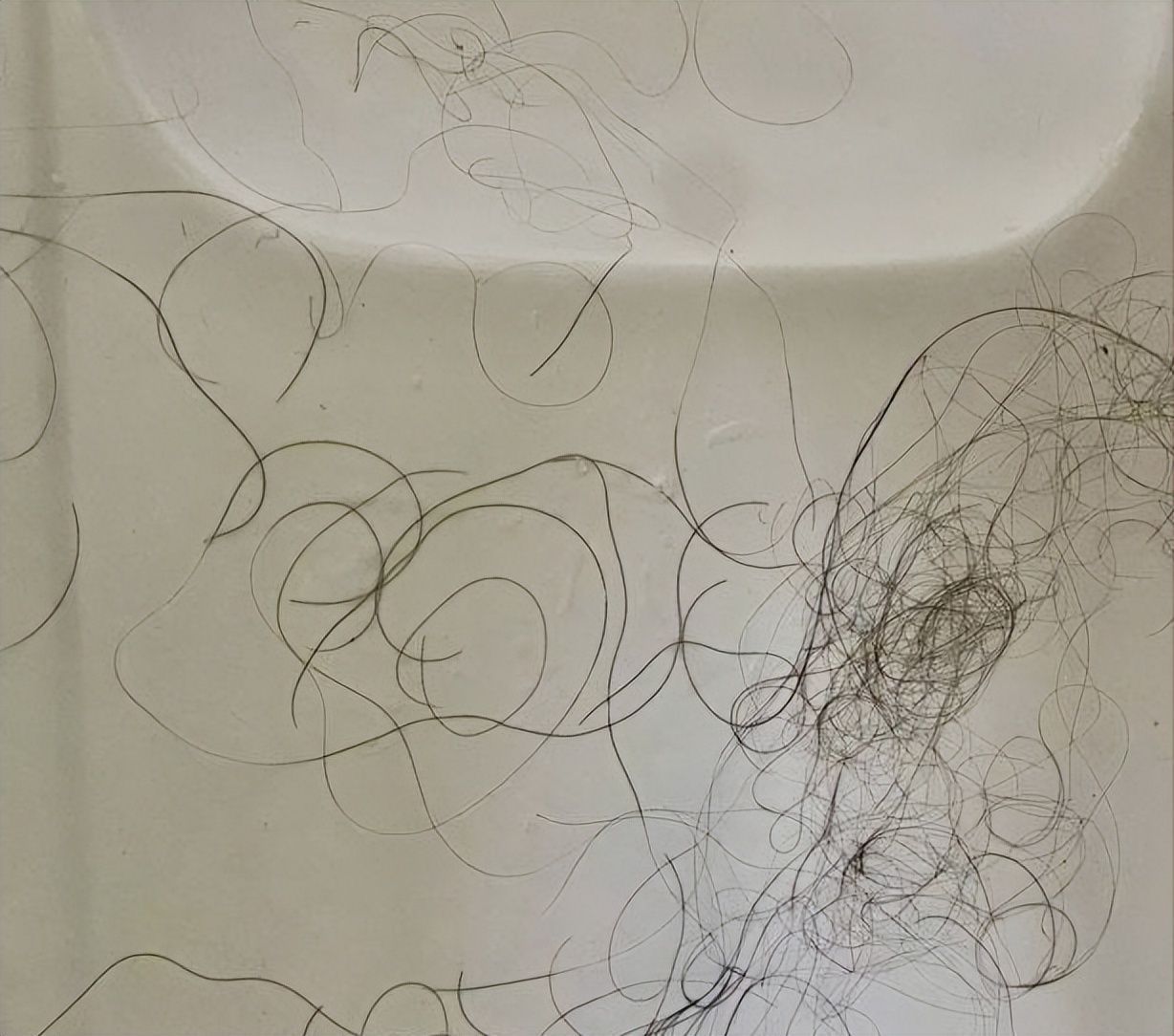 怀孕后用什么洗发露防掉发,怀孕后头发特别油是怎么回事