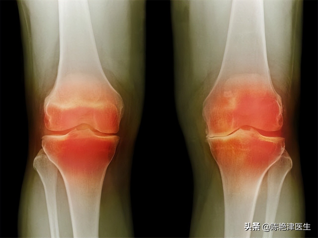 能控制但不能痊愈的病,只能治疗不能治愈的有什么病