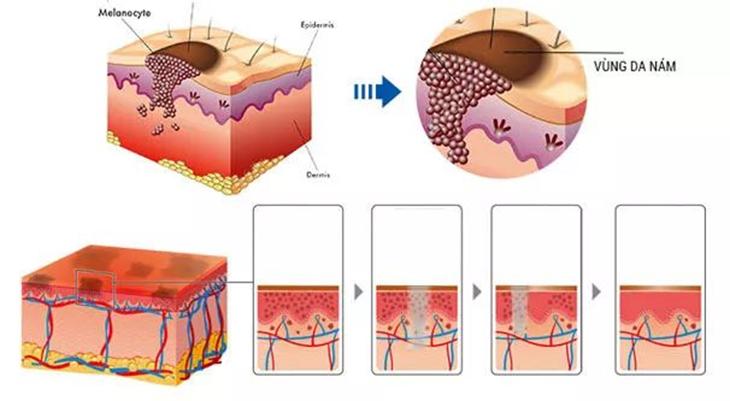 白瓷娃娃美白嫩肤,什么是白瓷娃娃美白嫩肤