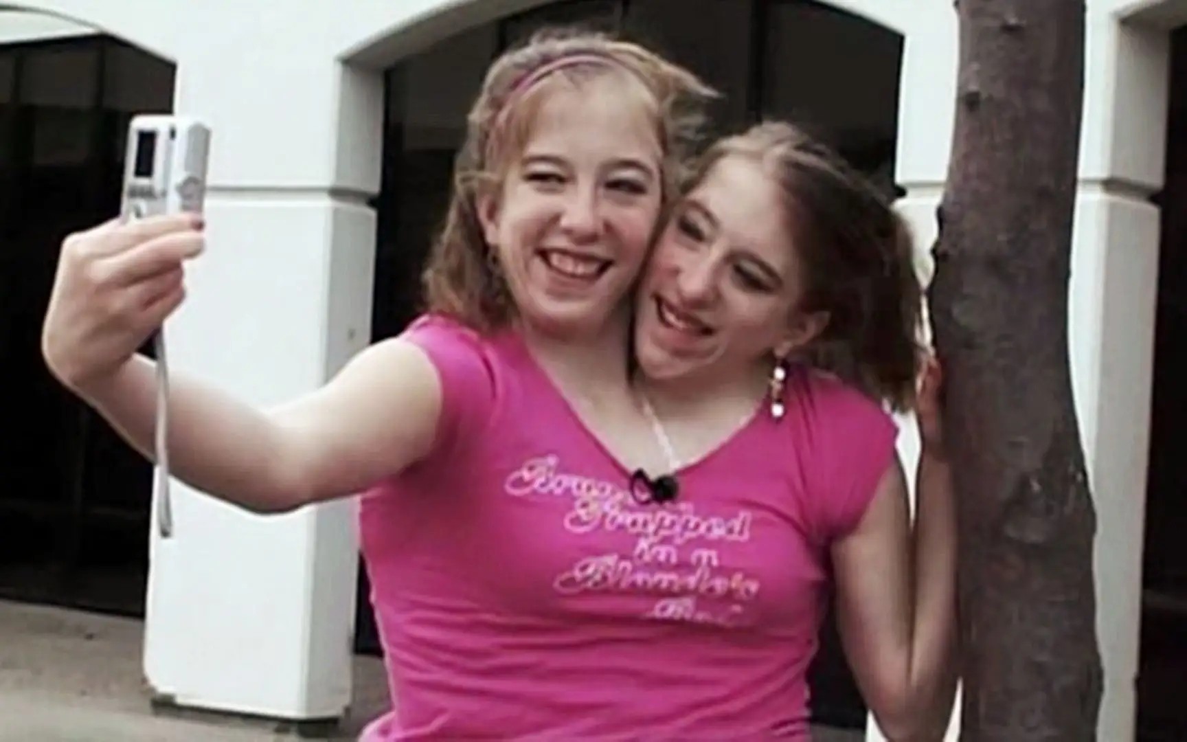 连体人是怎么诞生的,为什么会有雌雄连体人