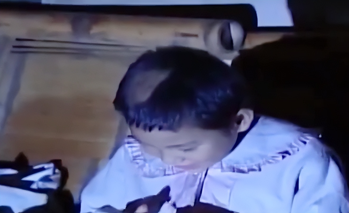 16年重庆女孩晕厥，醒来后扯头发吃，专家：吃头发对身体没有坏处