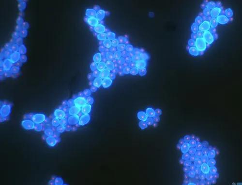 念珠菌真菌感染会引起尿频尿急吗,念珠菌真菌是什么