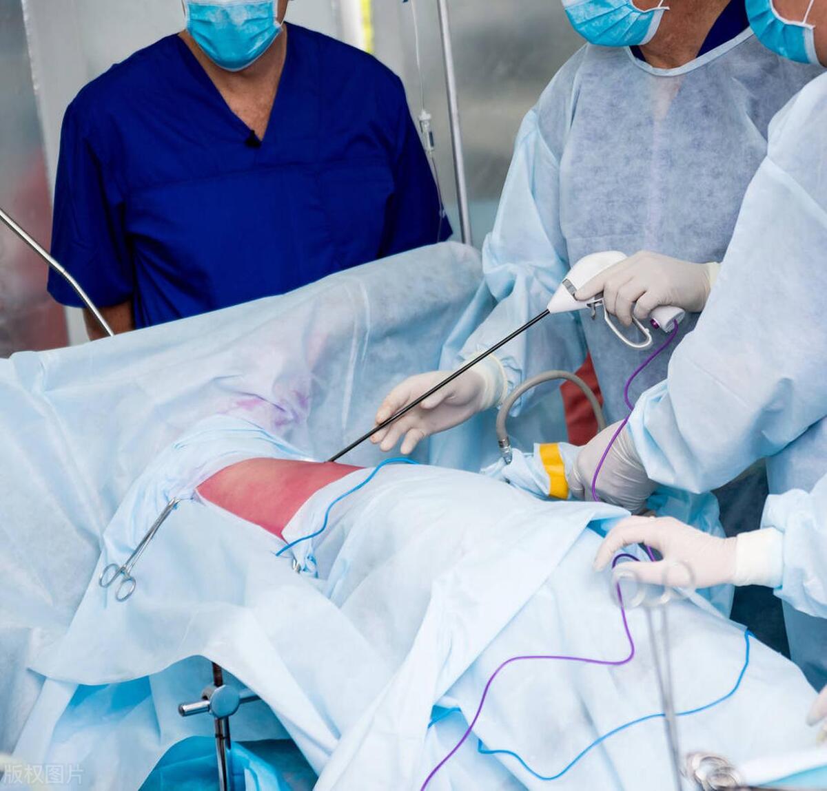 高分化癌和低分化癌有何区别,高分化癌和中分化癌是什么