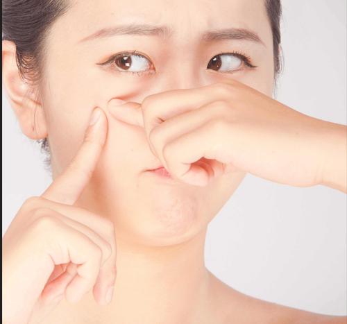 皮肤油腻易出油用什么香皂好,男士夏天皮肤出油