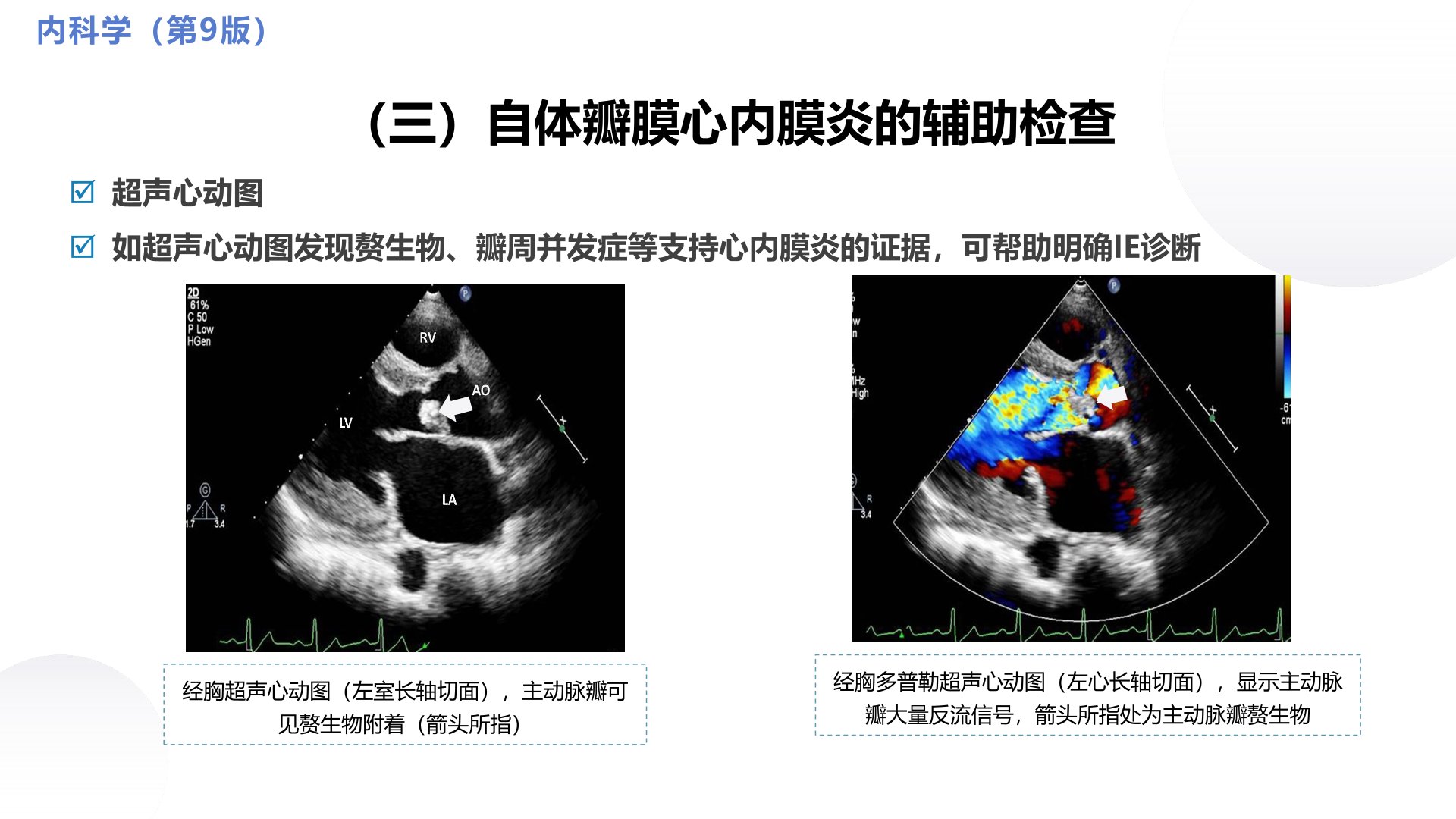 循环系统教学课件分享|第十章感染性心内膜炎的自体和人工区分
