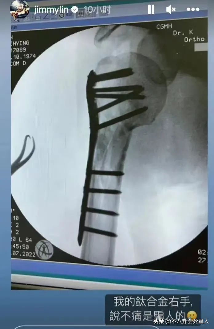 林志颖48岁生日现场照曝光,49岁林志颖面露凶相