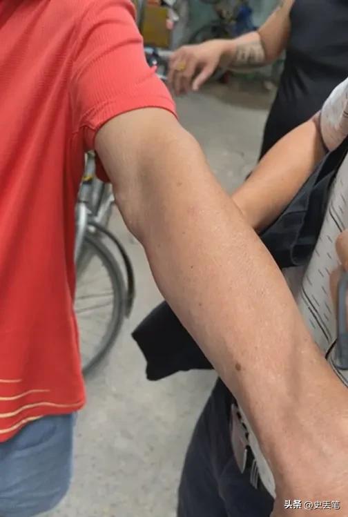 越南有位大爷从出生开始就浑身无毛，女友去世后他选择终身不娶