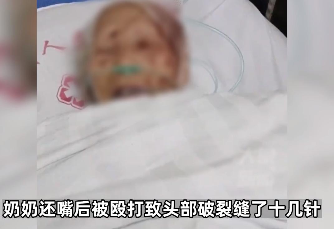 除夕夜儿媳殴打83岁婆婆，倒地后被丈夫一脚踢开，目前未脱离危险