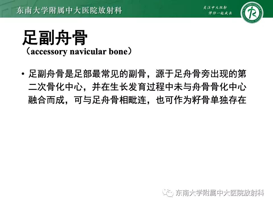 好文分享-《肌骨系统疾病——副舟骨综合征》