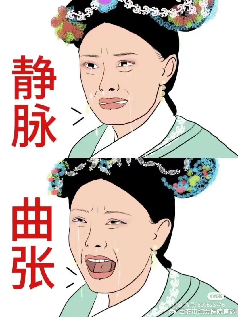 健康科普放血疗法,火针治疗静脉曲张的效果如何